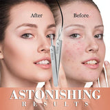 Professional Precision Salon Tweezers Style 2